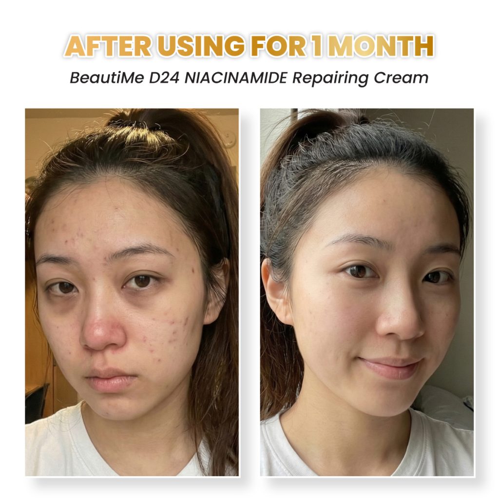 beautime ad 002 testimonial bf2