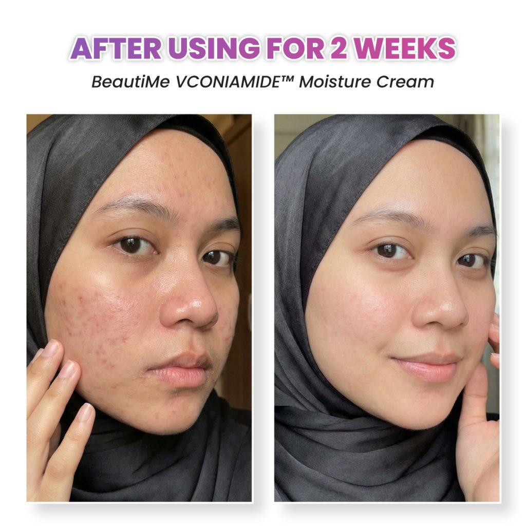 beautime ad 002 testimonial bf4