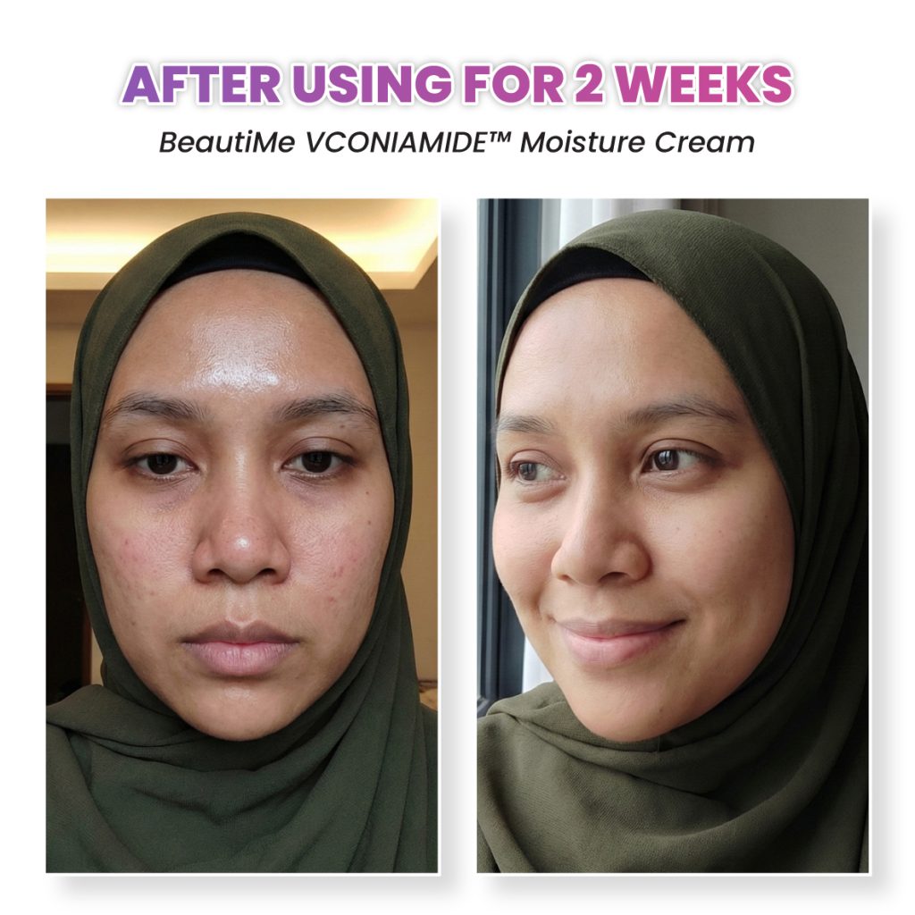 beautime ad 002 testimonial bf5