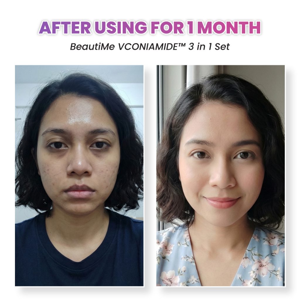 beautime ad 002 testimonial bf6