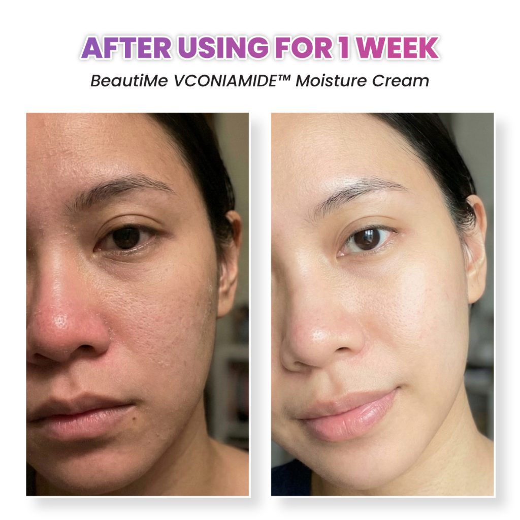 beautime ad 002 testimonial bf7