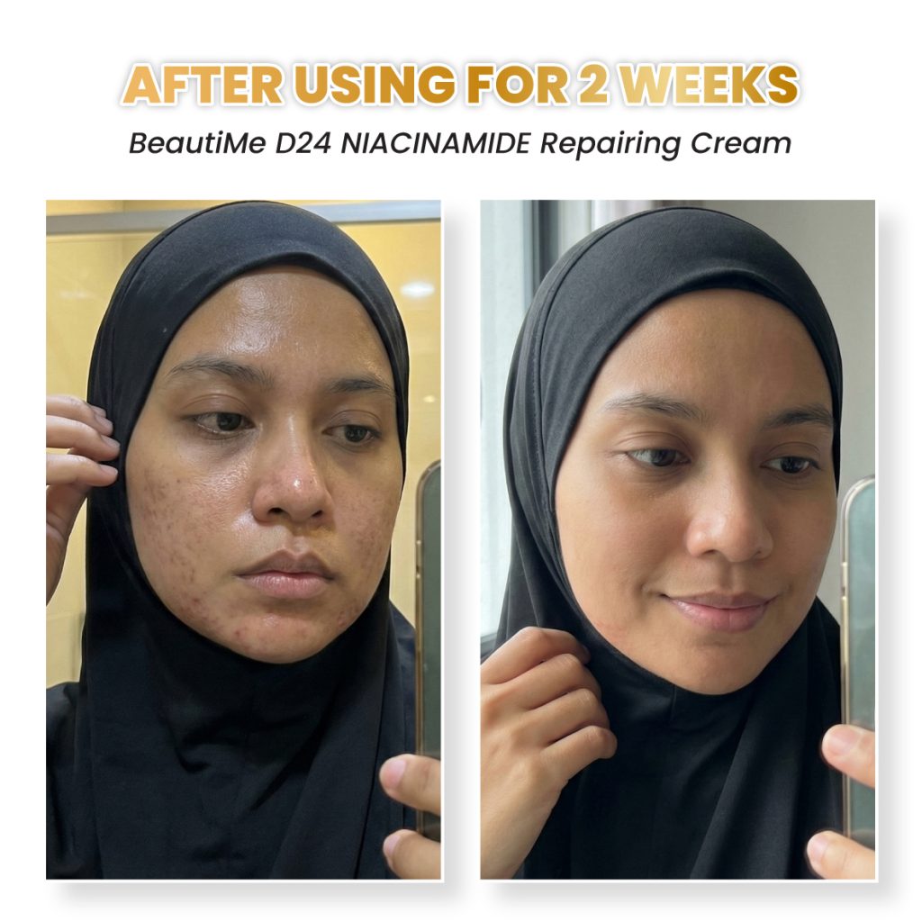 beautime ad 002 testimonial bf9